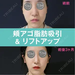 S.T styleクリニック 徳田 真紀子医師の症例