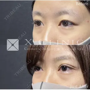 X CLINIC 恵比寿院の症例