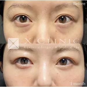 X CLINIC 恵比寿院の症例