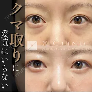 X CLINIC 恵比寿院の症例