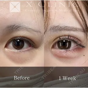 X CLINIC 恵比寿院の症例