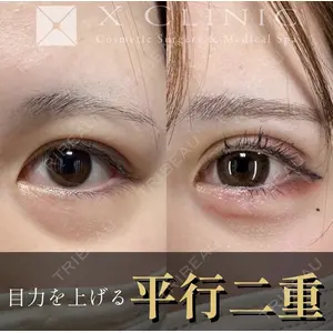 X CLINIC 恵比寿院の症例