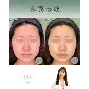 くさのたろうクリニック 立雅恵医師の症例
