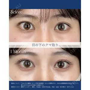 AI Beauty Clinic （エーアイ美容クリニック） 尾崎 宥文医師の症例