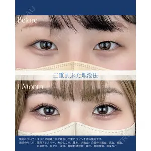 AI Beauty Clinic （エーアイ美容クリニック） 尾崎 宥文医師の症例