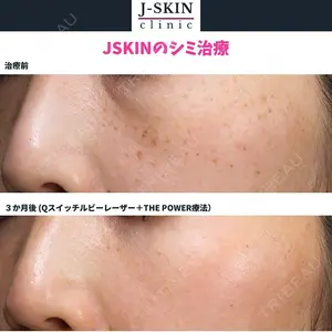 Jスキンクリニック 【J-SKIN clinic】 牧野　潤医師の症例