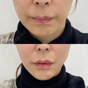 APスキンクリニック銀座の症例
