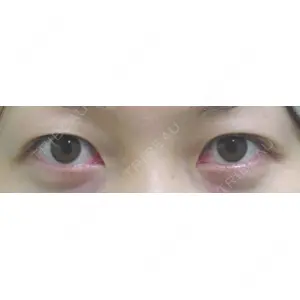 ドクター松井クリニック 新宿 松井　彰一郎医師の症例