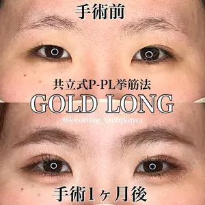 共立美容外科 千葉院の症例