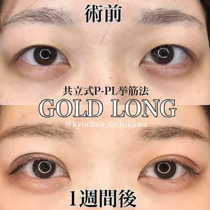 共立美容外科 千葉院の症例