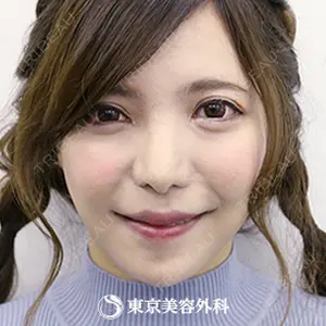 東京美容外科 青森院の症例