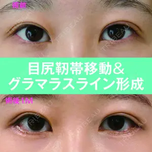 S.T styleクリニック 徳田 真紀子医師の症例