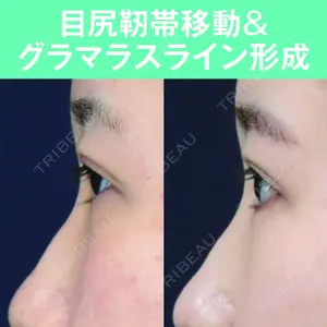 S.T styleクリニック 徳田 真紀子医師の症例