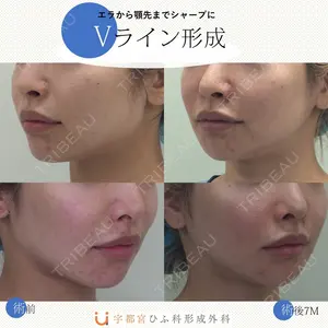 宇都宮ひふ科形成外科 宇都宮 裕己医師の症例