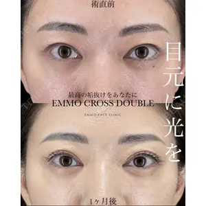 EMMO FACE CLINIC 大宮院 廣松 直樹医師の症例