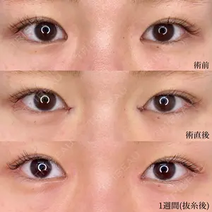 東京シンデレラ美容外科 大宮院の症例