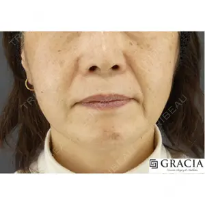 GRACIA clinic 【グラシアクリニック】の症例