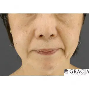 GRACIA clinic 【グラシアクリニック】の症例