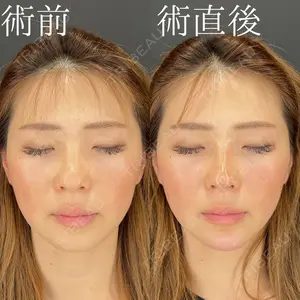 HAAB×DREAM BEAUTY CLINIC 大阪梅田院 柏木 太雅医師の症例