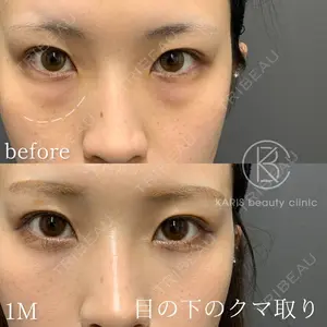 KARIS beauty clinic 滝内 ヒロフミ医師の症例