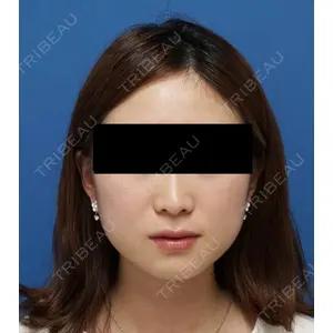 もとび美容外科クリニック 新宿院 西尾 謙三郎医師の症例