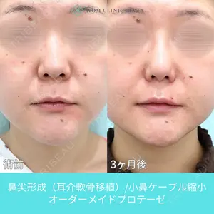 WOM CLINIC GINZA （ワム クリニック ギンザ） 佐々木 和司医師の症例