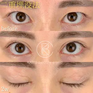 KARIS beauty clinic 滝内 ヒロフミ医師の症例
