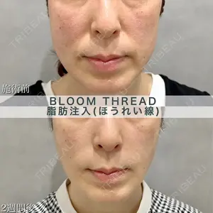 ブルームクリニック（BLOOM CLINIC） 大西 雅樹医師の症例