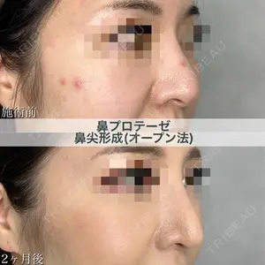 ブルームクリニック（BLOOM CLINIC） 大西 雅樹医師の症例