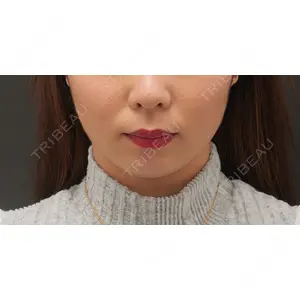 東京イセアクリニックの症例