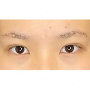 Wi Clinic（ウィ クリニック） 銀座院の症例