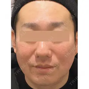 Wi Clinic（ウィ クリニック） 吉祥寺院の症例