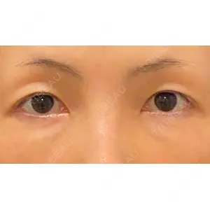 Wi Clinic（ウィ クリニック） 吉祥寺院の症例