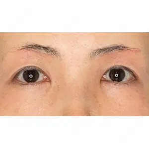 Wi Clinic（ウィ クリニック） 吉祥寺院の症例