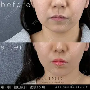 X CLINIC 銀座院の症例