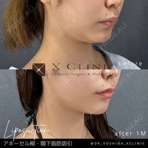 X CLINIC 銀座院の症例