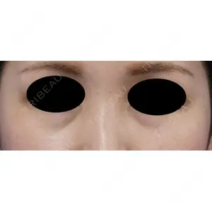 もとび美容外科クリニック 新宿院 西尾 謙三郎医師の症例