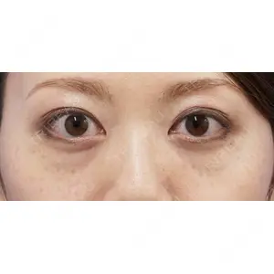 もとび美容外科クリニック 新宿院 西尾 謙三郎医師の症例