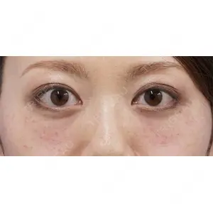 もとび美容外科クリニック 新宿院 西尾 謙三郎医師の症例