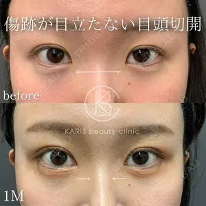 KARIS beauty clinic 滝内 ヒロフミ医師の症例