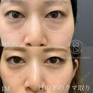 KARIS beauty clinic 滝内 ヒロフミ医師の症例