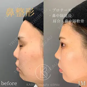 KARIS beauty clinic 滝内 ヒロフミ医師の症例