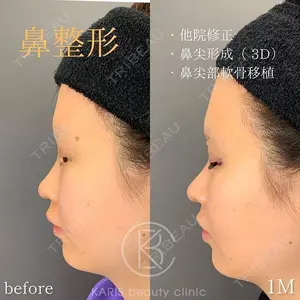 KARIS beauty clinic 滝内 ヒロフミ医師の症例