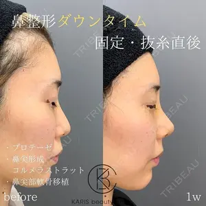 KARIS beauty clinic 滝内 ヒロフミ医師の症例