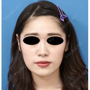 もとび美容外科クリニック 新宿院の症例