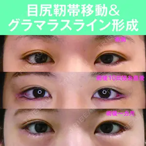 S.T styleクリニック 徳田 真紀子医師の症例