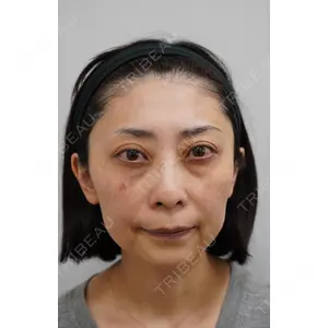 セオリークリニック 筒井　裕介医師の症例