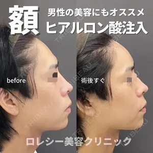 ロレシー美容クリニック 心斎橋駅前院 福留院長医師の症例