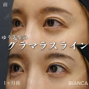 BIANCA表参道 大久保 由有医師の症例