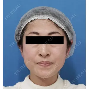 もとび美容外科クリニック 新宿院 西尾 謙三郎医師の症例
